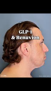 Experience Life-Changing Breast Reduction Results with Dr. Chuck Schafer's  Expertise