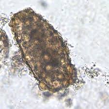 Dpdx Ascariasis Images Microbiology Parasite Study Materials