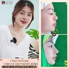 🌟 MŨI 10 NGÀY CHO DÁNG MŨI TỰ NHIÊN...