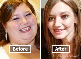 128 Surprising Photos of Face Fat Loss Before and After Weight Loss