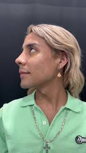 @Paqjonathan rhinoplasty resulrs 😍😍 #cosmeticsurgery  #amazing_fact_watch_full_video ##fypシ