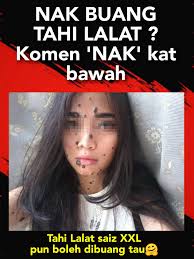 Keberadaannya bahkan bisa mempermanis wajah kita. X Mole Cara Buang Tahi Lalat Ketuat Kutil Biji Kolestrol Facebook