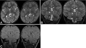 Image result for Incidental Imaging Finding