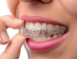 My experience with tempe dental was great! Tempe Dentist 85283 Noble Dental Care