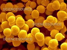 Image result for Staphylococcus Saprophyticus