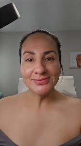 Quieres un cambio en ti piel verte super...??🤔, 💥 CARBON LASER 💥, Lo vas  Amar😍😍