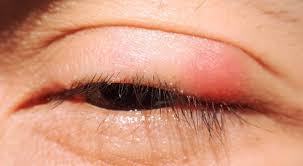 Image result for Blepharis affinis