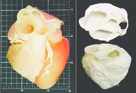 A 3d Model Of Human Heart From Ct Scanner With Arduino Electronic Download Scientific Diagram We hope you enjoy our growing collection of hd images to use as a background or home screen for your smartphone or computer. 3d model of human heart from ct scanner