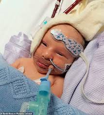 Grief of parents as their baby son dies less than a month after being born  with heart defect issue