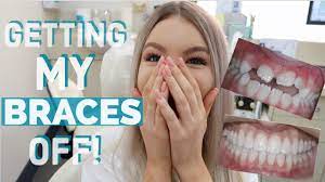 For the most part, the pain and sensitivity go away in a few. Getting My Braces Off Youtube
