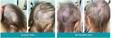 Moreover, educational strategies based on the relationship between nutrients and food and human health could. Simone Thomas Wellness Assesses The Damage That Covid 19 Has Had On Hair Loss
