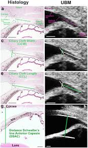 Ica , catalog , products. Plos One Determination Of Morphological Biometric And Biochemical Susceptibilities In Healthy Eurasier Dogs With Suspected Inherited Glaucoma