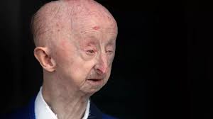 Generous Chronicle readers donate money to help Gateshead attack victim  Alan Barnes