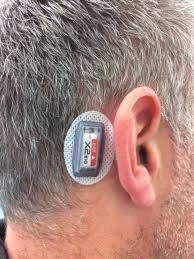 Did two payouts since then and now can't get any more $$$ out. The Magnitude Of Translational And Rotational Head Accelerations Experienced By Riders During Downhill Mountain Biking Journal Of Science And Medicine In Sport