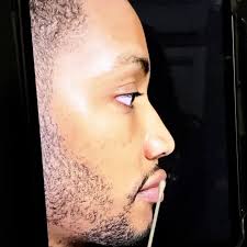 Ethnic Nose By Drboraok