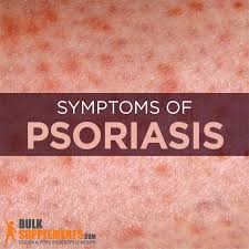 Image result for psoriasis