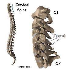 Cervical Facet Joint Syndrome E Algos