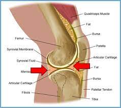 Bei einem innenmeniskusriss kommt es dementsprechend neben schmerzen zu einer funktionseinschränkung der kniebewegung. Meniskusriss Kleiner Schaden Mit Konsequenzen Outdoor