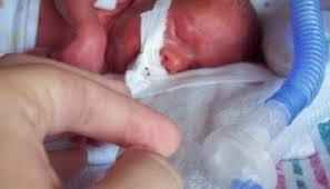 Ab wann haben babys fieber? Heute Uberleben Sogar Halbkilo Babys