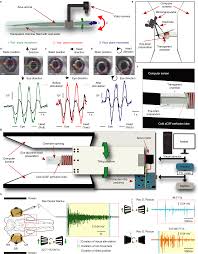 Image result for Oculovestibular Testing