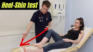 Image result for Rapid Alternating Movements