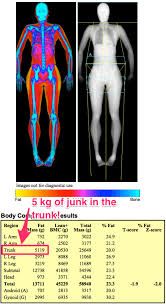 How A Dexa Body Fat Muscle And Bone Scan Can Help You Get Fit