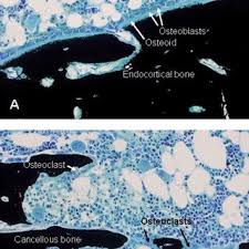 The basic unit of structure in compact bone is the osteon. Pdf Histological Analysis Of Bone