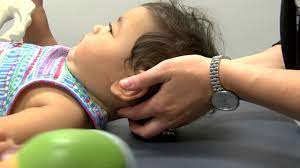 Omt Minute Condylar Decompression Technique For Infants Youtube