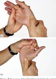 Image result for Scaphoid Shift Test