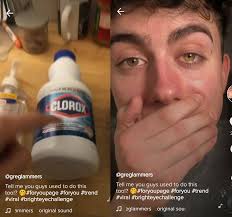 Maybe you would like to learn more about one of these? New Tik Tok Challenge Tik Tok Challenge