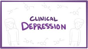 Depression Ao1 Ao2 Psychology Wizard