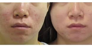 Restore Cosmetic and Skin Surgery