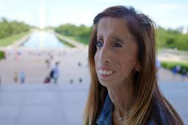A Brave Heart: The Lizzie Velasquez Story (2015)