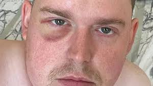 'Doctors said my agonising symptom was stress