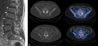 Image result for Low Back Imaging