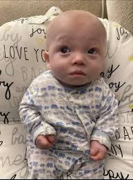 ADNA GRAD RECOVERING FROM SEVERE STROKE: May 7 started as a typical day for  Kody Rolfe. He put in a full day of work at Braun Northwest, helped a  friend with some