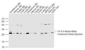 Start studying alpha beta gamma. 14 3 3 Alpha Beta Gamma Delta Epsilon Antibody Bioss