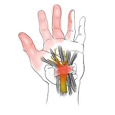 Image result for karp ln  tunel ort za