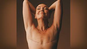 Image result for Mastectomy