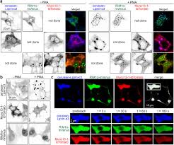Camera de hotel 309 ep. Phosphorylation Triggers Presynaptic Phase Separation Of Liprin A3 To Control Active Zone Structure Biorxiv