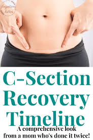 C Section Recovery Timeline Forgotten Lattes C Section Recovery Timeline C Section Recovery C Section