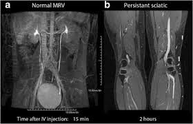 Check spelling or type a new query. Spr 2013 Springerlink