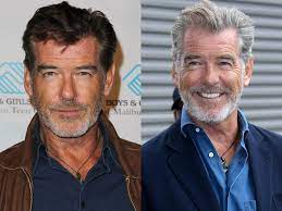 Discover the most famous people whose name starts with a. Before And After Photos Of Celebrities With Gray Hair