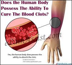 If you are at an increased risk for blood clots, considering including pineapples in your dessert after as many meals as possible. Does The Human Body Possess The Ability To Cure The Blood Clots