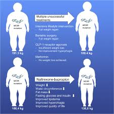 Image result for Bupropion