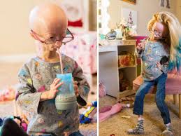 Girl 11 With Rare Ageing Condition Racks Up 170m Youtube Views For An Inspiring Reason Daily Star