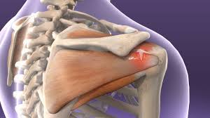 Image result for Rotator Cuff Injury