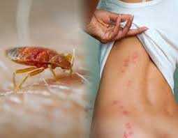 All pest control can be shipped to you at home. In Home Residential Bed Bugs Pest Control In Mumbai Id 16435332348