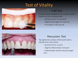 Percussion testing on tooth no. Dental Emergency Emergency Most Common Condition Ppt Download