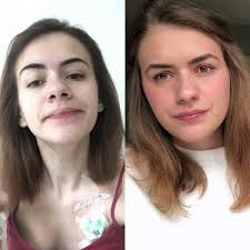 Life-changing treatment: How a new drug helped one woman to breathe again